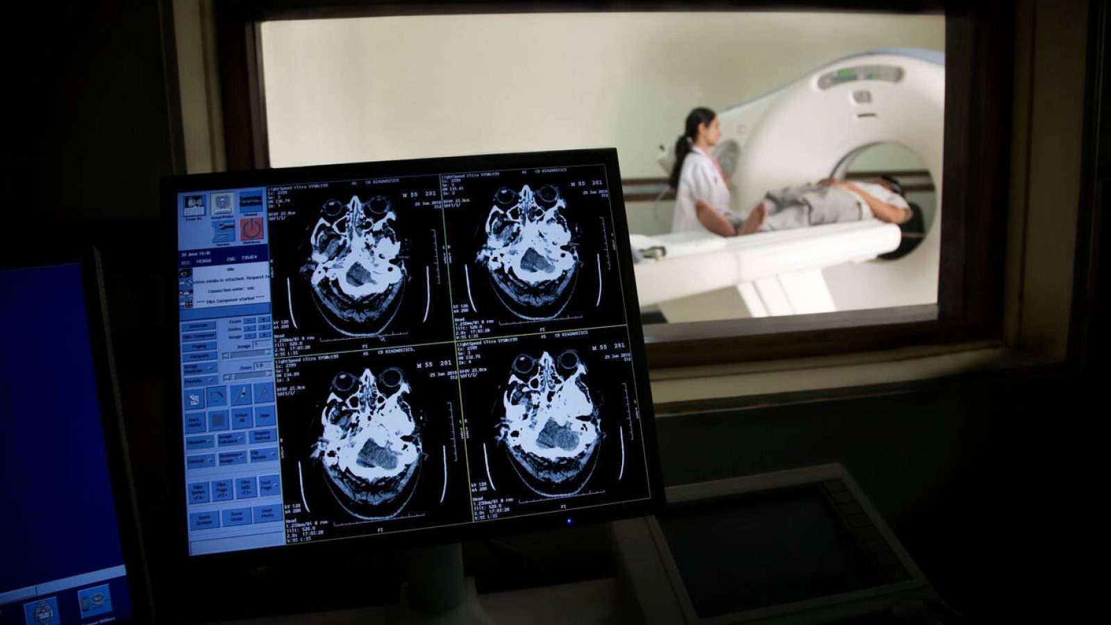 PACS dan RIS untuk Klinik Kecil: Perlu atau Belum?