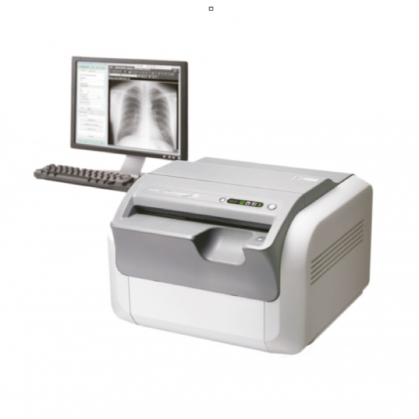 Computed Radiography (CR System)
